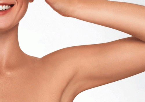 Skin laxity for arms and knees