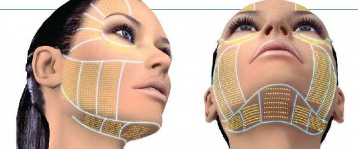 Aesthetic innovation of the face