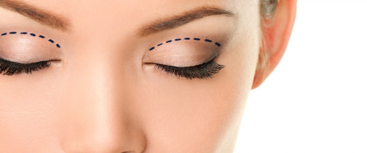 REDISCOVER THE BEAUTY OF YOUR EYES WITH BLEPHAROPLASTY